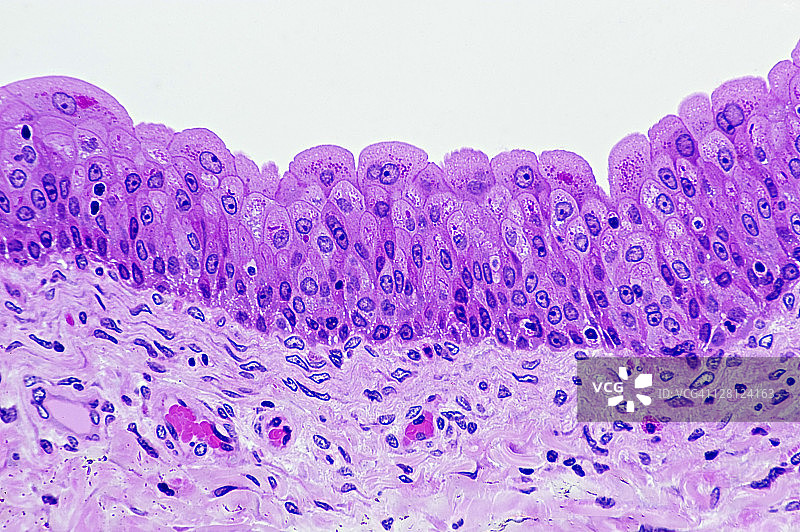 人膀胱移行上皮（放大100倍），H&E染色，表面附近的细胞是梨形基底膜，下方有支持性结缔组织图片素材