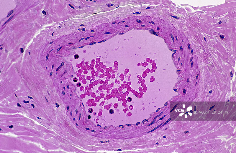 正常动脉横截面（H&E染色，100倍）图片素材