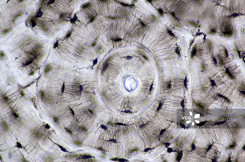 人类哈弗氏系统（骨单位）的骨骼，具有突出的骨小管和腔隙。（放大倍数x100）图片素材