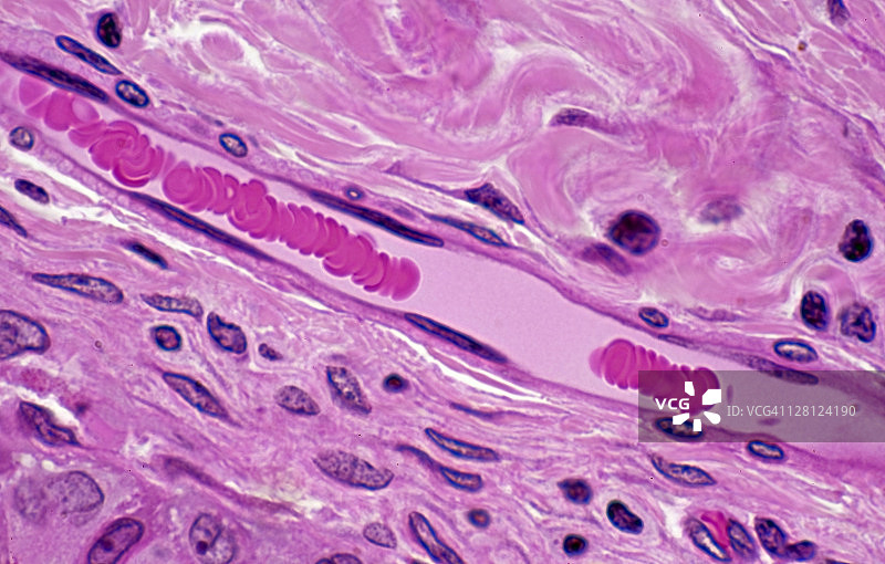 毛细血管中的红细胞（250倍放大），红细胞形成缗钱状图片素材