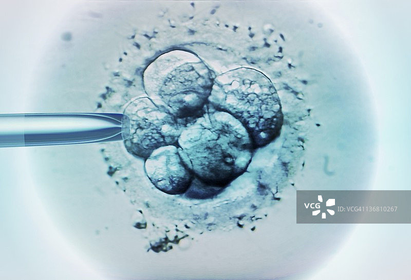 试管婴儿胚胎选择显微照片图片素材
