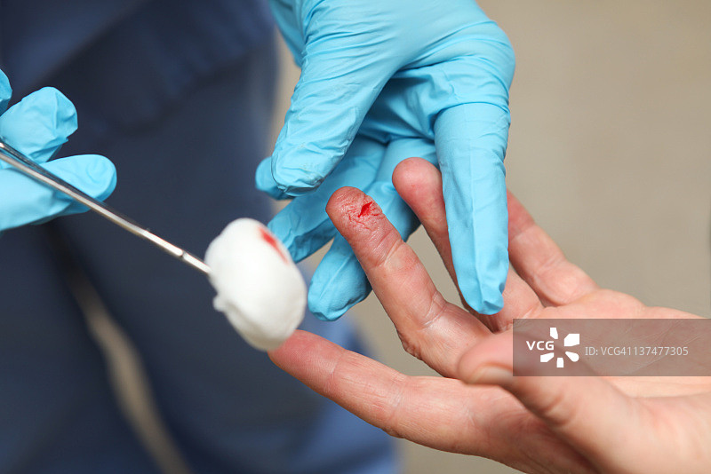 护士正在为受伤患者的手指更换绷带图片素材