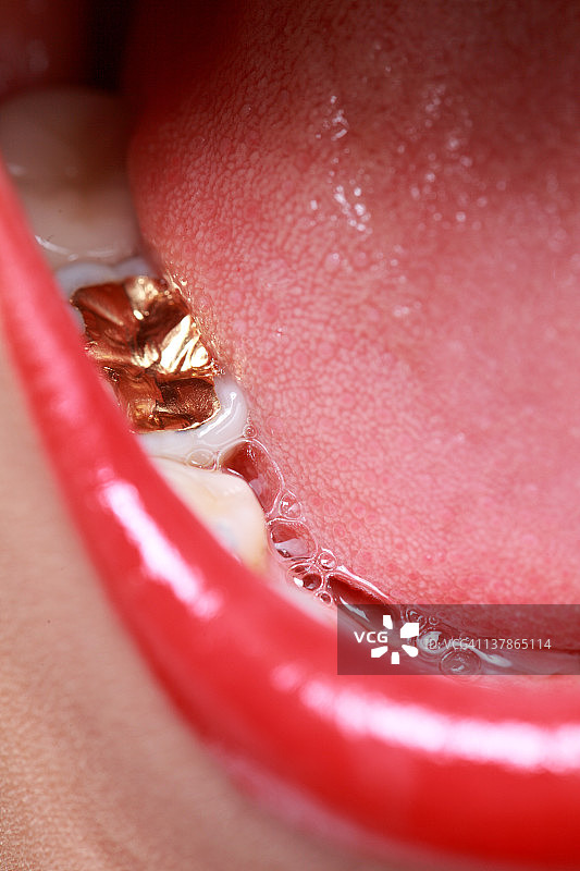 有金牙的年轻女人图片素材