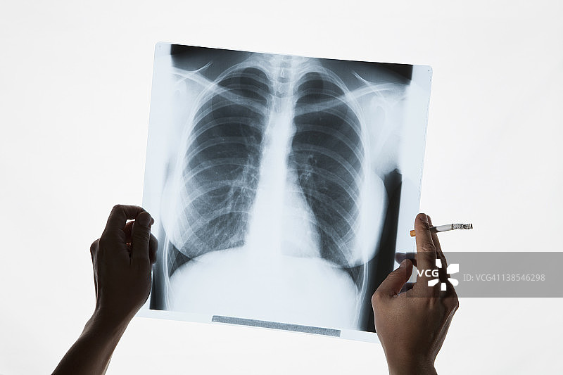手持胸部X光片和香烟特写图片素材