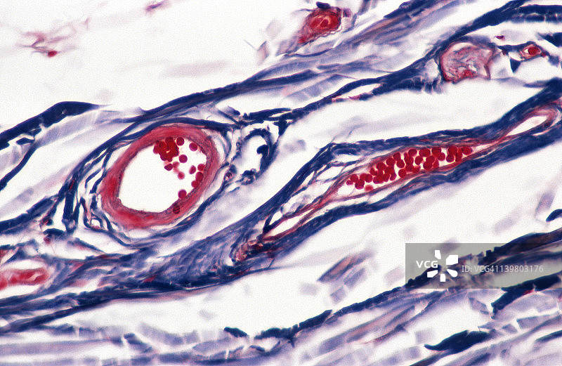 血管，皮肤；皮下层，小静脉（右），小动脉（左），红细胞。35毫米处100倍图片素材