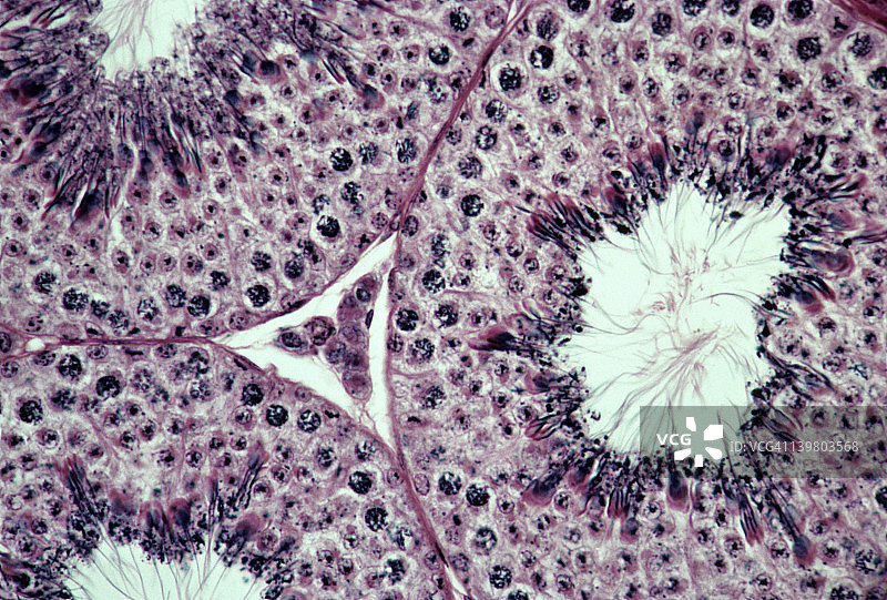睾丸生精小管，精子发生，100倍放大。显示：生精小管、精子发生、精子、管腔和间质细胞（Leydig 细胞）。图片素材