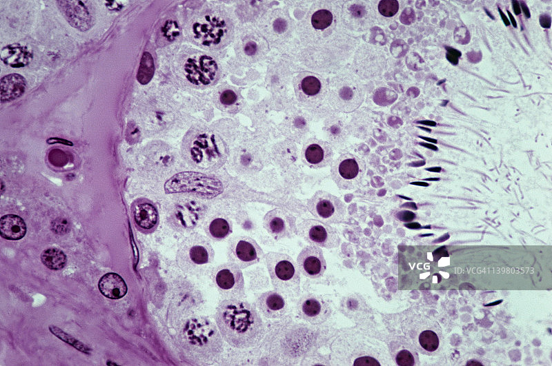 精子发生过程：曲细精管，睾丸，250倍。显示：精原细胞，精母细胞（含染色体），精子细胞，精子，管腔，间质细胞（Leydig细胞，分泌睾酮），支持细胞（或Sertoli细胞）图片素材