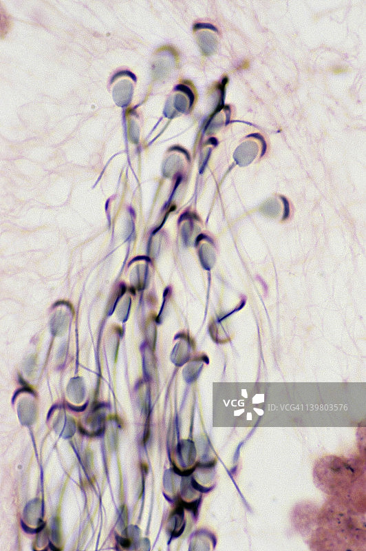 带有顶体的精子，放大250倍。显示：头部、鞭毛和顶体（分泌酶帮助穿透卵子）。精子位于曲细精管中。豚鼠。图片素材