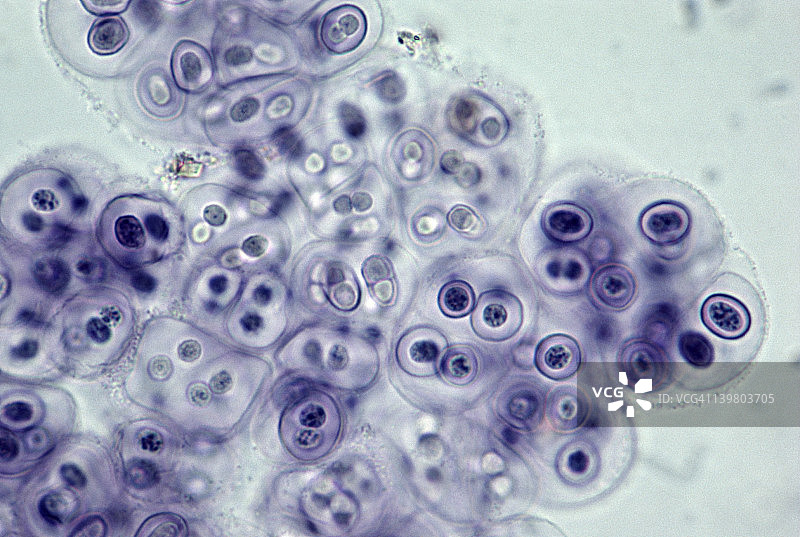 蓝绿藻、蓝细菌。固氮单细胞藻类细胞包裹在层中。250X图片素材