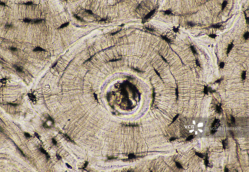 骨骼（致密）：骨单位或哈弗斯系统，100倍放大。显示：骨单位（哈弗斯）管，板层，骨小管和小腔（活骨中骨细胞的位置）。骨骼是一种支持性结缔组织，也称为骨组织。图片素材