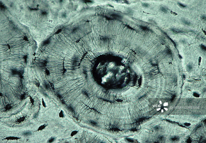骨骼（致密）；骨单位或哈弗斯系统，35毫米处100倍。显示：骨（哈弗斯）管，板层，小管和腔隙（黑色空间，包含活骨中的骨细胞）。骨是支持结缔组织，又称骨组织图片素材