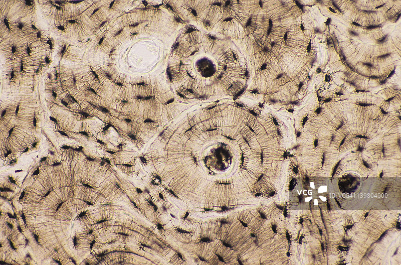 骨骼（致密）：骨单位或哈弗斯系统，50倍放大图片素材