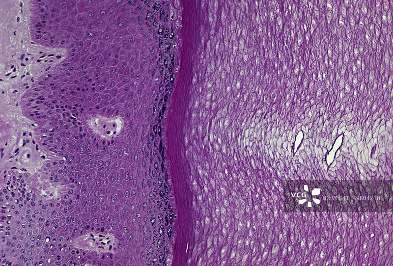手掌皮肤。显示：汗腺导管、角质层、表皮层、真皮层、基底层和棘层，35毫米处放大50倍图片素材