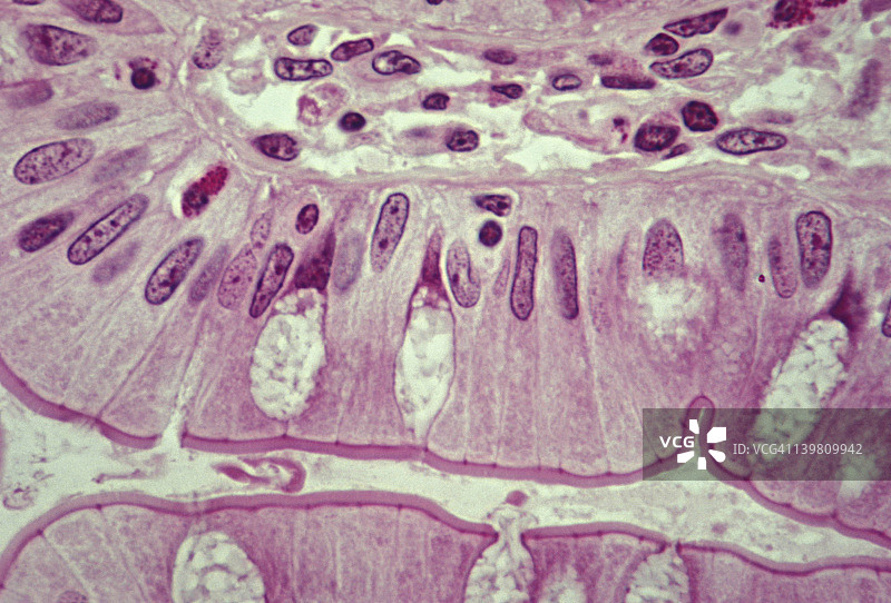 人回肠单层柱状上皮和杯状细胞（250倍放大），杯状细胞含粘液，显示有纹状缘由微绒毛组成图片素材
