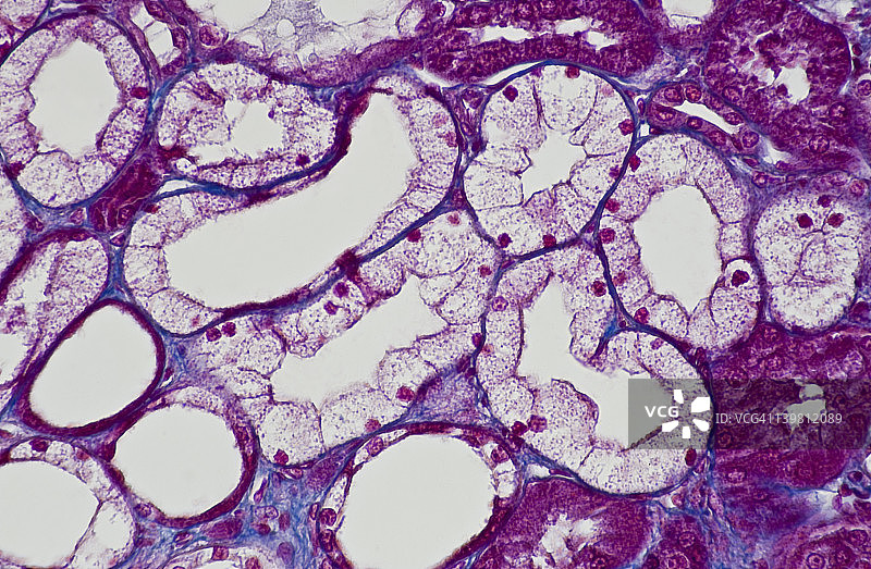 人立方上皮细胞，肾小管，横截面和纵向截面（放大倍数x100）显示形成肾小管（肾单位的一部分）、管腔和蓝色结缔组织的立方上皮细胞。一些小管显示较扁平图片素材