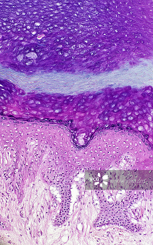 人体厚皮的五个表皮层（或地层），放大倍数x50。从下到上：基底层、棘层、颗粒层、透明层和角质层。下方还显示真皮。图片素材