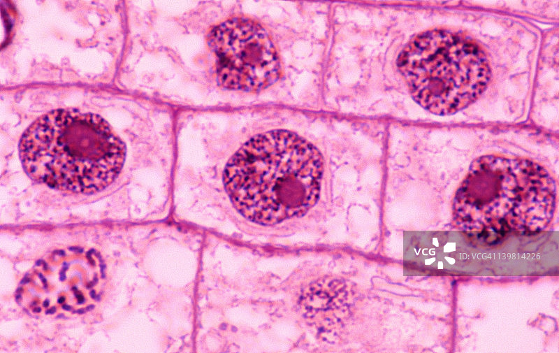 洋葱根尖有丝分裂间期（放大倍数400倍）：细胞核、核膜、核仁和染色质图片素材