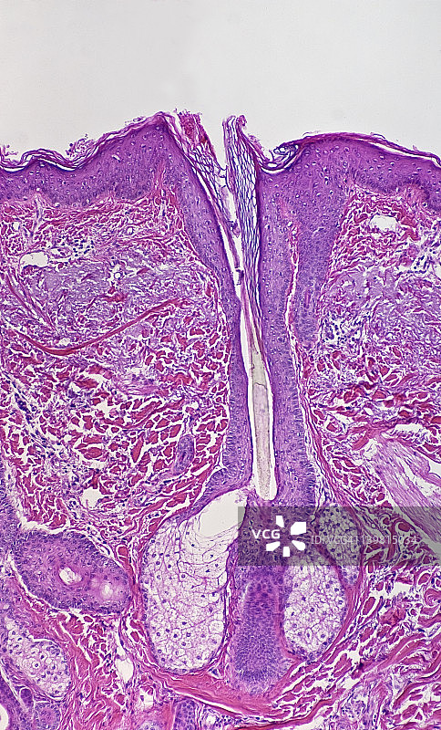 人头皮的皮脂腺和毛囊（放大倍数x25）H＆E染色。显示毛囊、头发、表皮和真皮以及立毛肌图片素材