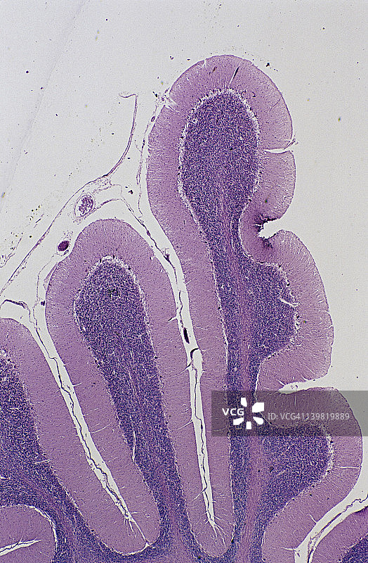 小脑；大脑，5倍，35毫米。显示：小脑皮层的灰质、分子层、浦肯野细胞层、颗粒层、白质、脑膜图片素材