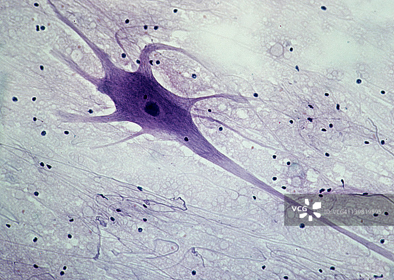 运动神经元；脊髓，50倍放大，35毫米。显示：细胞体、细胞核、树突（附着在细胞体上的多个突起）、轴突（单条长神经纤维）和神经胶质细胞（黑点）。图片素材