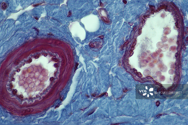 动脉（左）和静脉（右）横截面图片素材