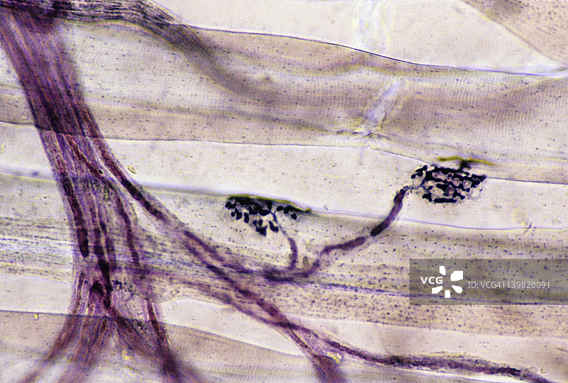 神经肌肉接头，35毫米100倍，显示：神经肌肉接头（运动终板）、运动神经元轴突和骨骼肌纤维或细胞（有条纹）图片素材