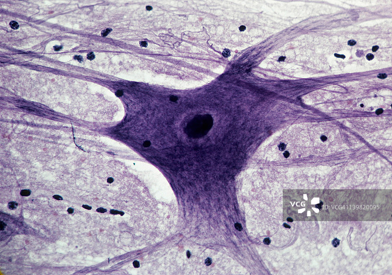 运动神经元、脊髓在35毫米下的50倍放大图：显示细胞体、细胞核、树突和神经胶质细胞（黑点）图片素材