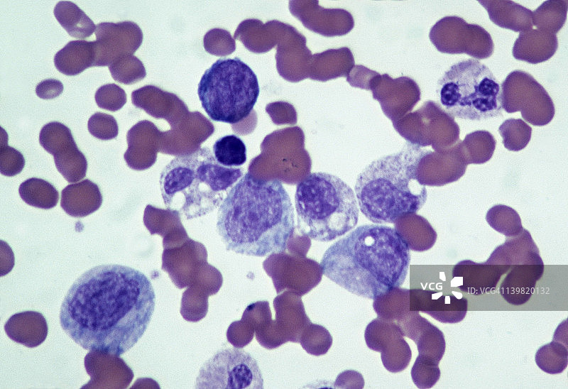 人骨髓切片：正常骨髓在35mm下250倍放大，显示造血组织及未成熟细胞分化为成熟血细胞和血小板图片素材