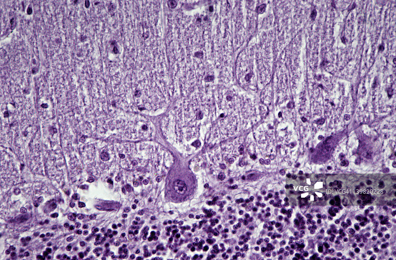 普肯野细胞（神经元）；小脑，100倍图片素材