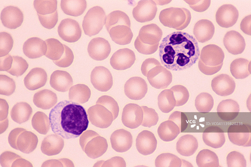 淋巴细胞和中性粒细胞：白细胞（400倍放大）图片素材