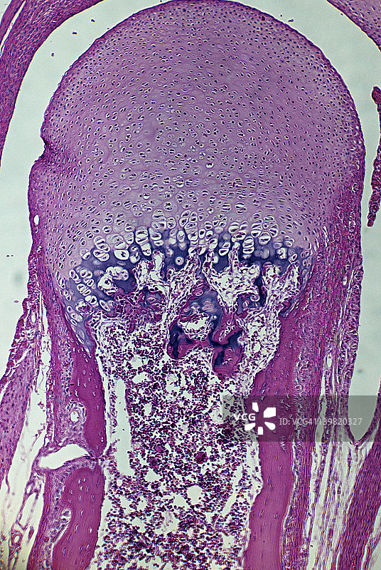 骨骼发育：软骨骨化，骨骺盘图片素材