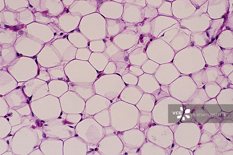 脂肪组织：脂肪细胞，100倍放大，35毫米。显示：脂肪细胞（脂肪细胞）、细胞核和细胞质（推到外围）以及脂肪滴（大而清晰的区域）。一种特殊的结缔组织。图片素材