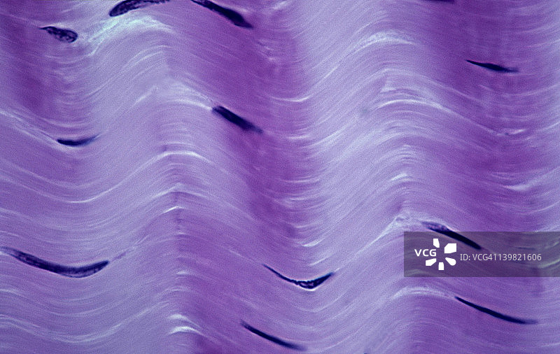 密集的纤维结缔组织：规则的肌腱，胶原纤维和成纤维细胞图片素材