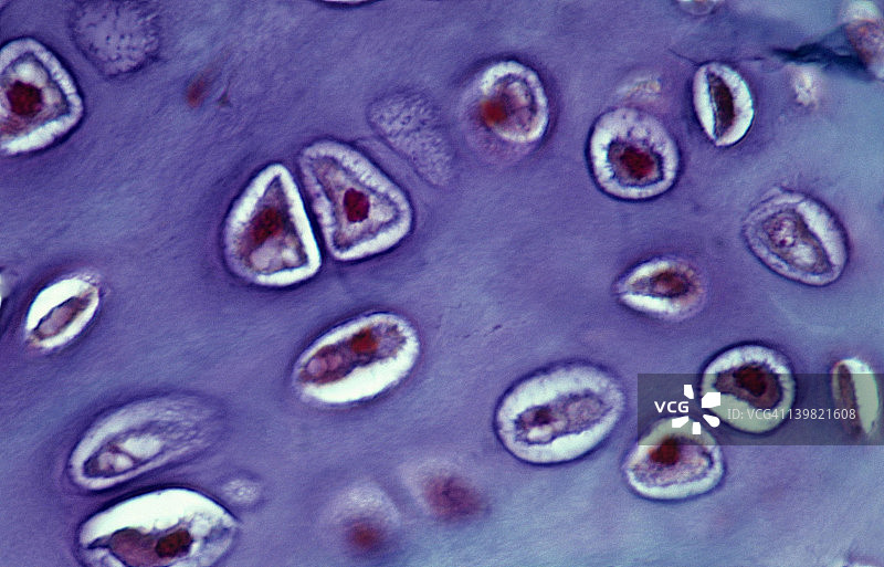 透明软骨：软骨细胞、基质与陷窝图片素材