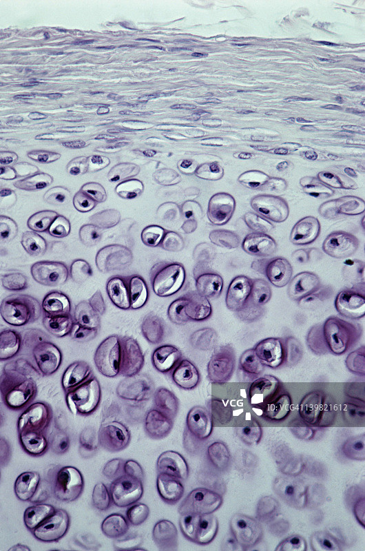 透明软骨；气管，支撑结缔组织，100倍放大图片素材