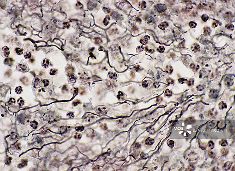 网状结缔组织：淋巴结图片素材