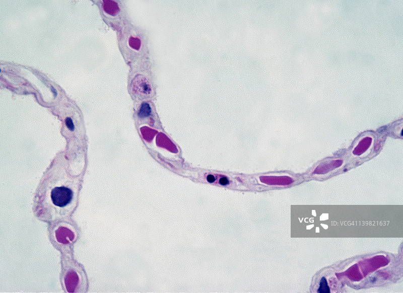肺泡壁、肺泡和呼吸膜，正常人肺组织，250X，35mm图片素材