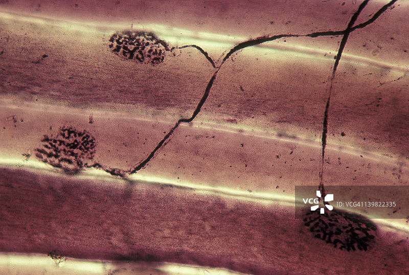 神经肌肉接头、运动终板、运动神经纤维、轴突、骨骼肌纤维、细胞100倍图片素材