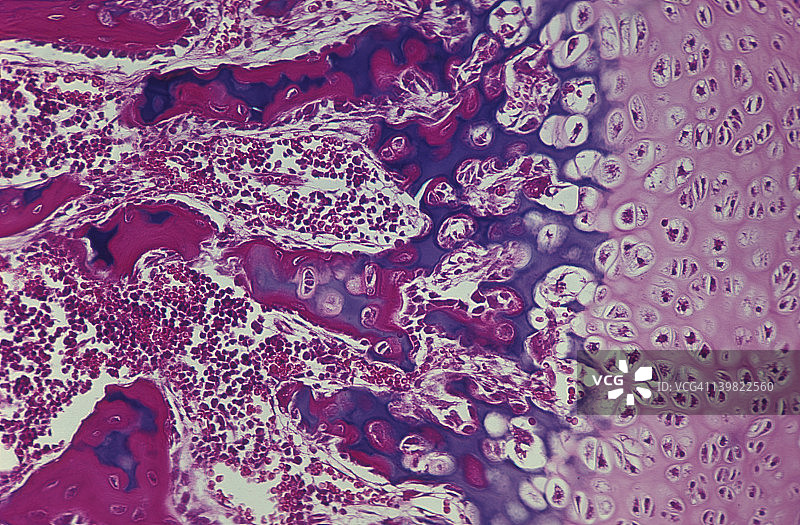 猴子指骨发育过程中软骨内骨化的显微照片，显示钙化软骨；50倍放大图片素材