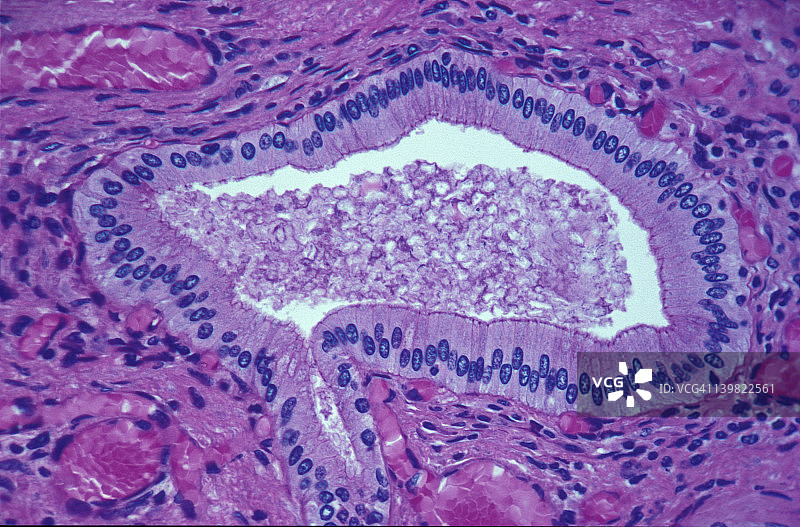 胰腺导管单层柱状上皮的光学显微照片，显示带紫色细胞核的柱状细胞；100倍图片素材