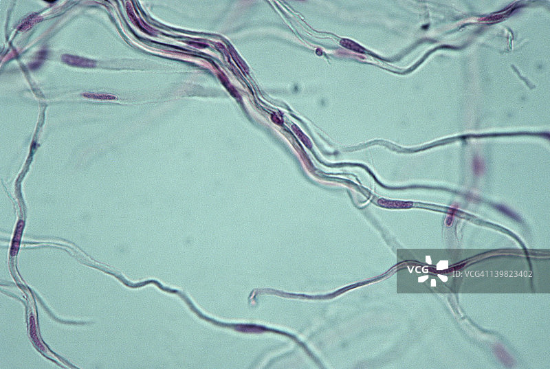 平滑肌。挑逗，小肠，100X显示：细胞核，细胞质和锥形肌纤维（或细胞）。非横纹肌，不随意肌。图片素材