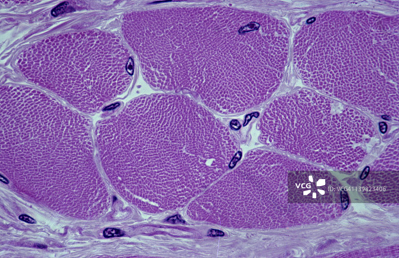 骨骼肌纤维（细胞）。横截面，250倍显示：肌纤维（细胞）、肌原纤维、外周核、肌内膜、肌束膜和部分肌束（纤维束）。图片素材