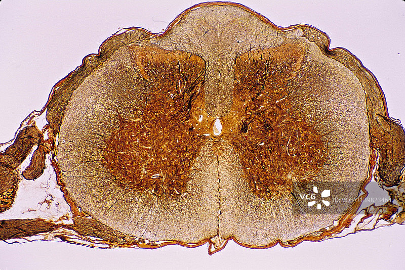 脊髓横截面，5X显示：灰质（金蝴蝶）、白质、中央管、背根和腹根、背根神经节、脑膜、背角、腹（前）角和前角细胞（运动神经元细胞体）图片素材