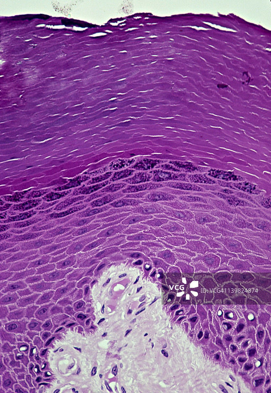 复层鳞状上皮表皮（角质化，厚皮，人，100倍）。显示表皮层：角质层，颗粒层，棘层和基底层（表皮基底层）。此外，显示下面的真皮（较浅）。图片素材