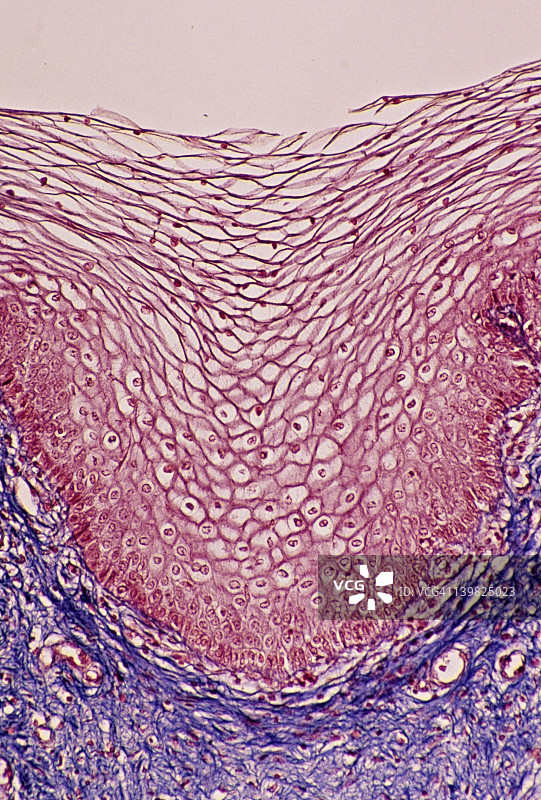 复层鳞状上皮（阴道，非角化）50倍图片素材