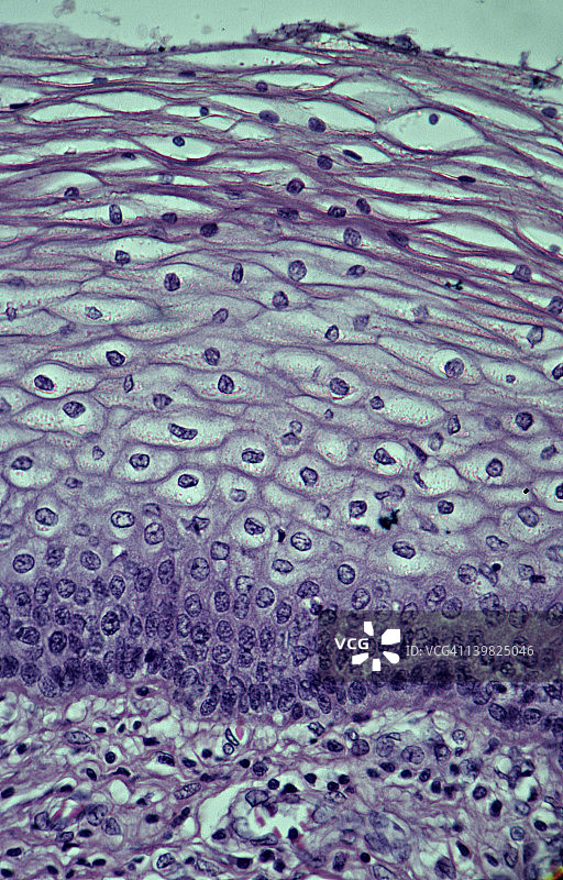 复层鳞状上皮：阴道非角化，100倍放大。此上皮具有多层结构，表面细胞变得非常扁平。下方显示支持性结缔组织。图片素材