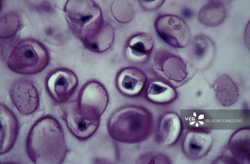 透明软骨：软骨细胞、软骨陷窝、基质，1000倍图片素材
