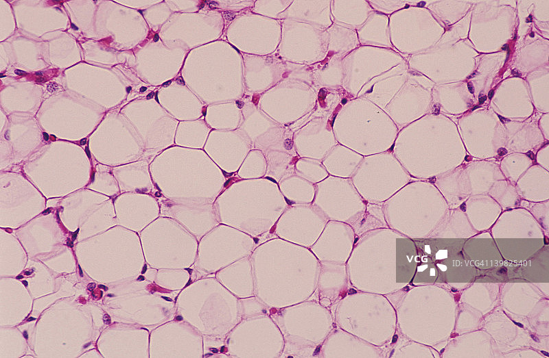 脂肪组织：脂肪细胞、脂肪细胞核和细胞质被推到外围，结缔组织，100倍图片素材