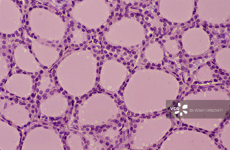 甲状腺：滤泡、胶体和单层立方上皮图片素材