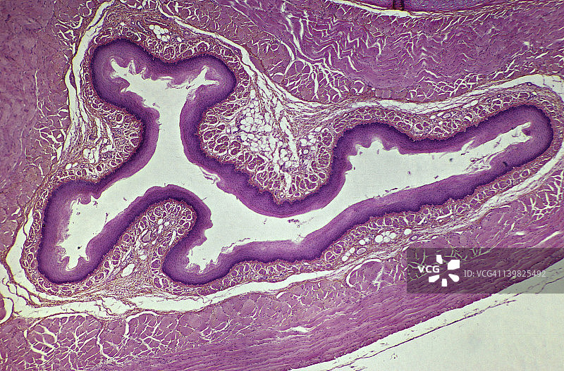 食道横截面，10倍放大：显示黏膜、黏膜下层、肌层、外膜和管腔图片素材